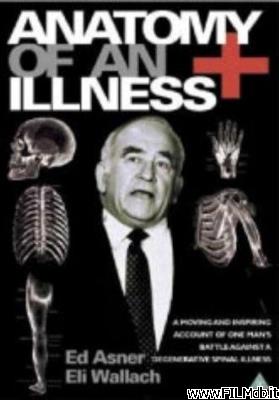 Poster of movie Anatomy of an Illness [filmTV]